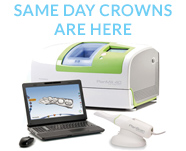 same day crowns